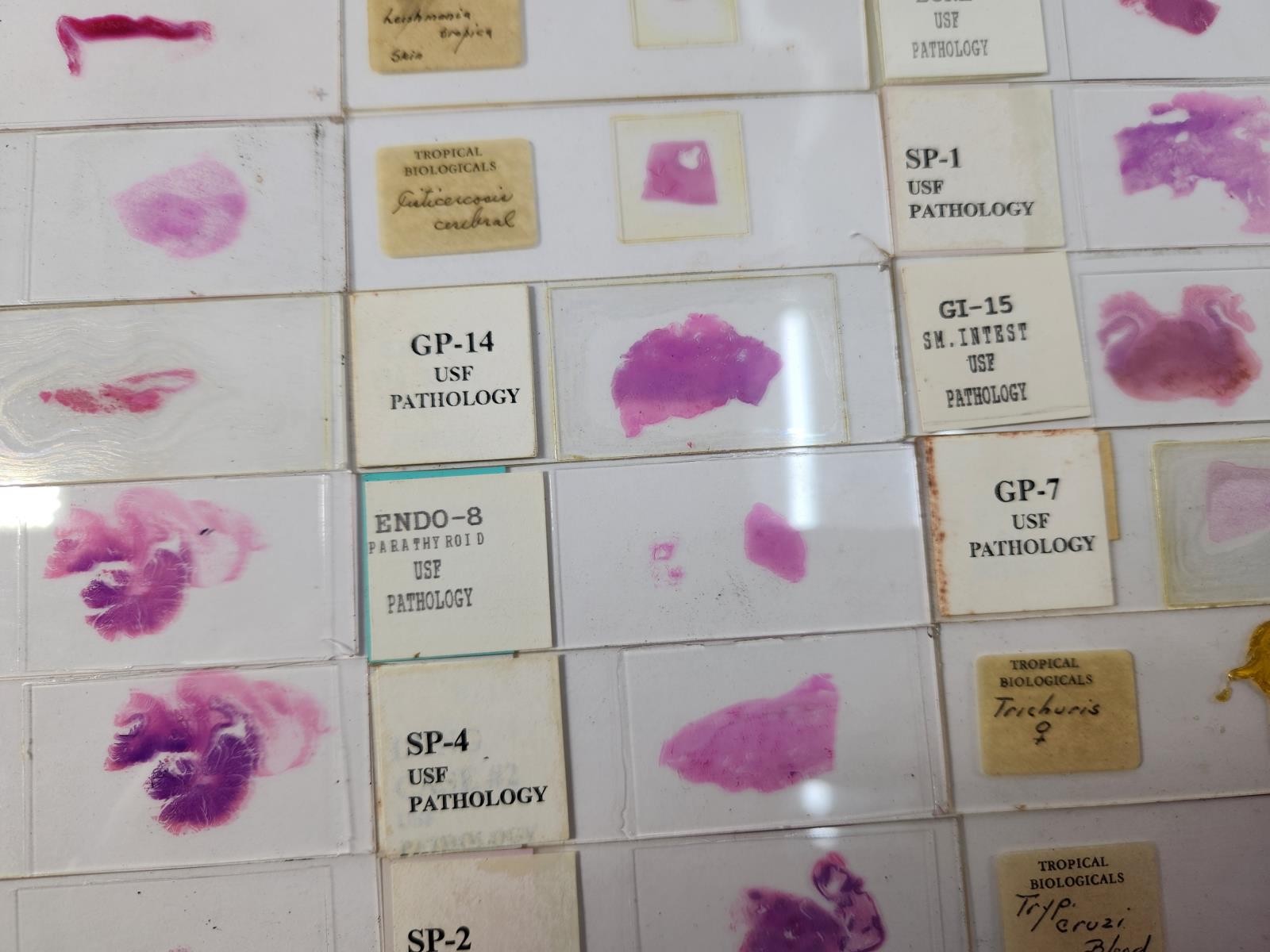 Lot Of 50 Vintage University Prepared Pathology Microscope Slides - Slides Only