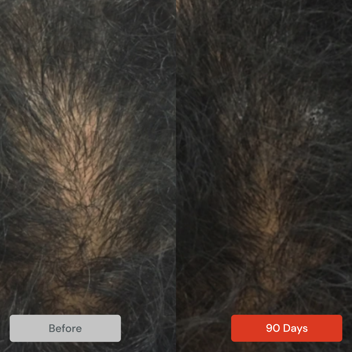 REVITA Shampoo (925ml) by DS Laboratories for Thinning Hair