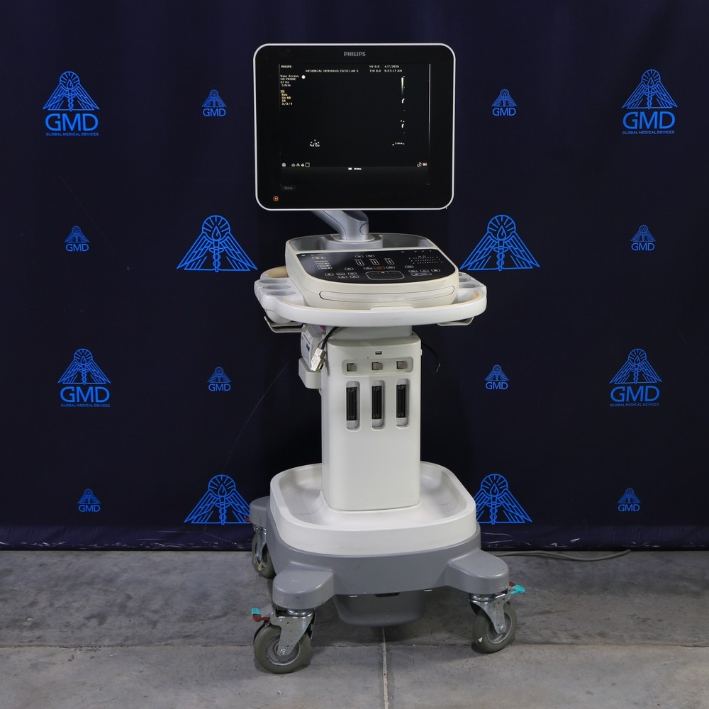 Philips Sparq Ultrasound System