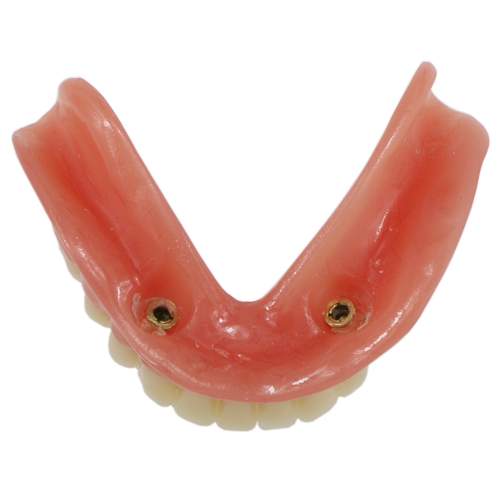 Dental Implant Typodont Teeth Restoration Model Series Overdenture Practice Demo