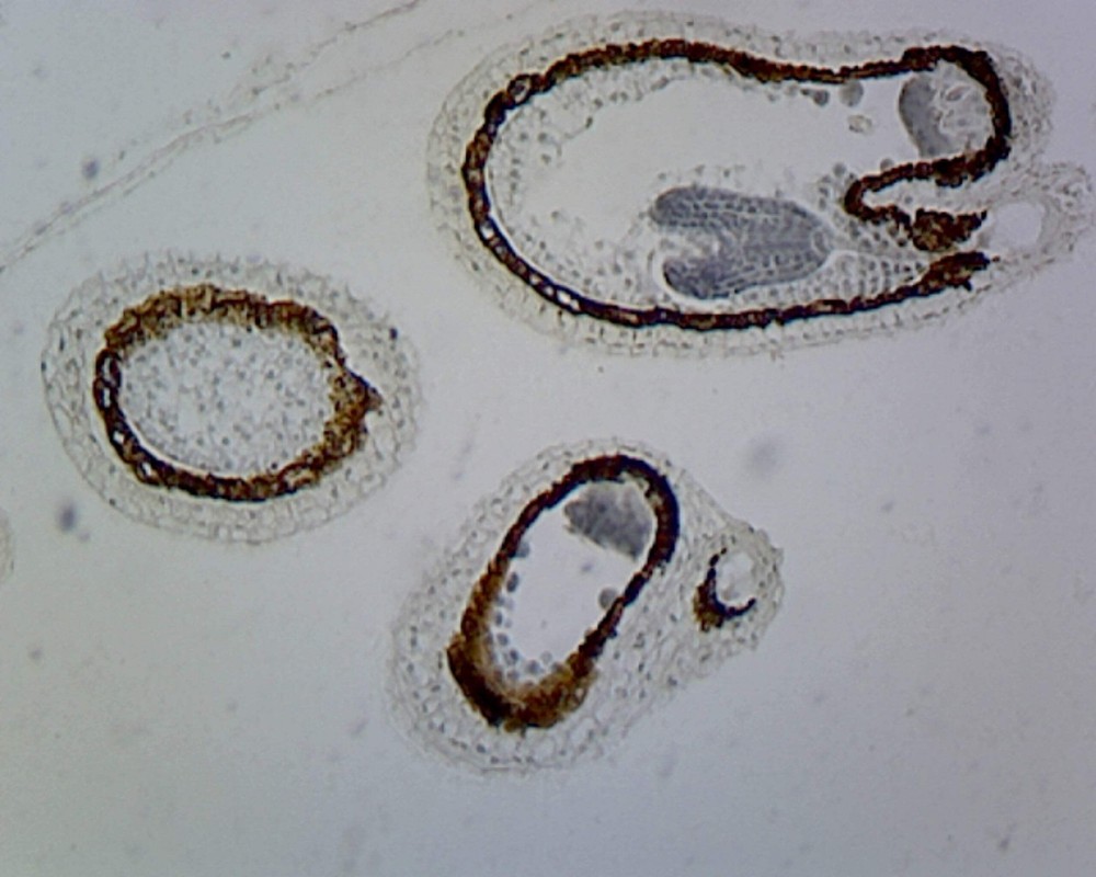 Capsella Embryo, Precotyledon Stage; Lateral Section