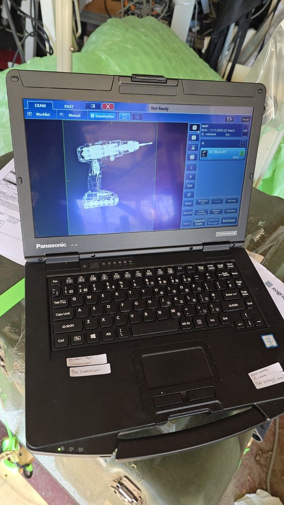 digital portable ray machine canon