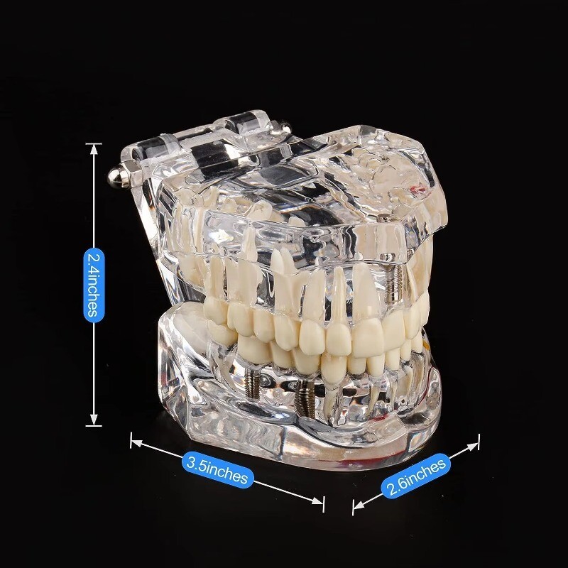 Medical Pathological Extrusion Missing Teeth Model Dental Teaching Teeth Model