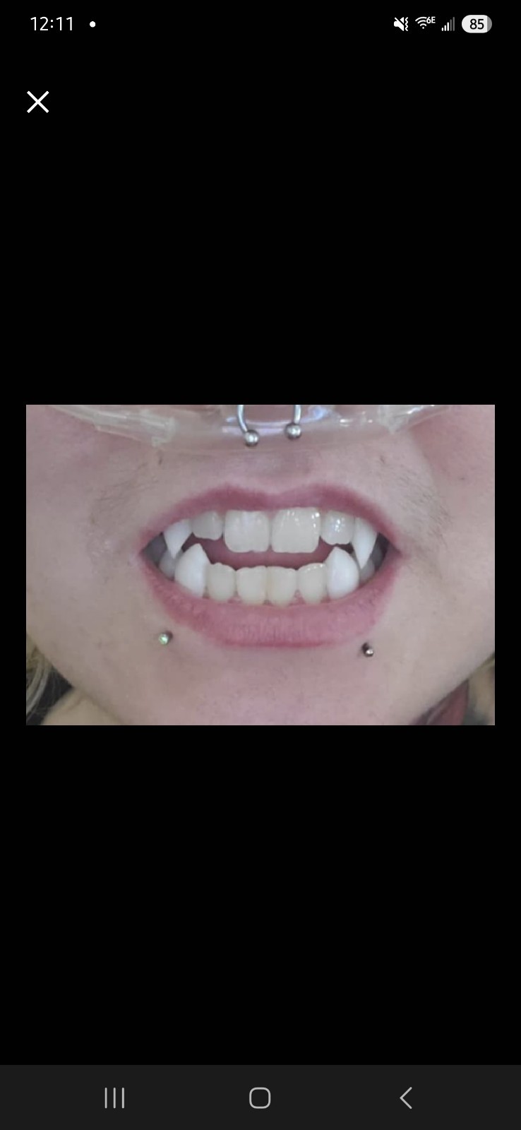 Custom Retainer Upper with Vampire Fangs, made for a great fit. fast shipping.