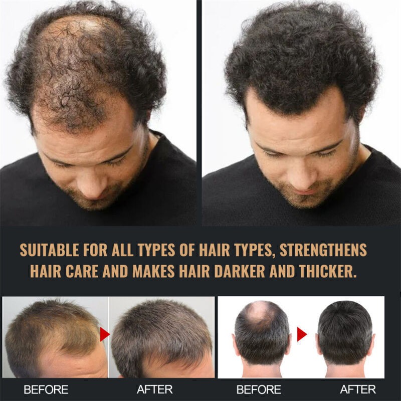 2pc Shampoo,Spartan Root Activator Shampoo,Natural Hair Regrōwth Shampoo