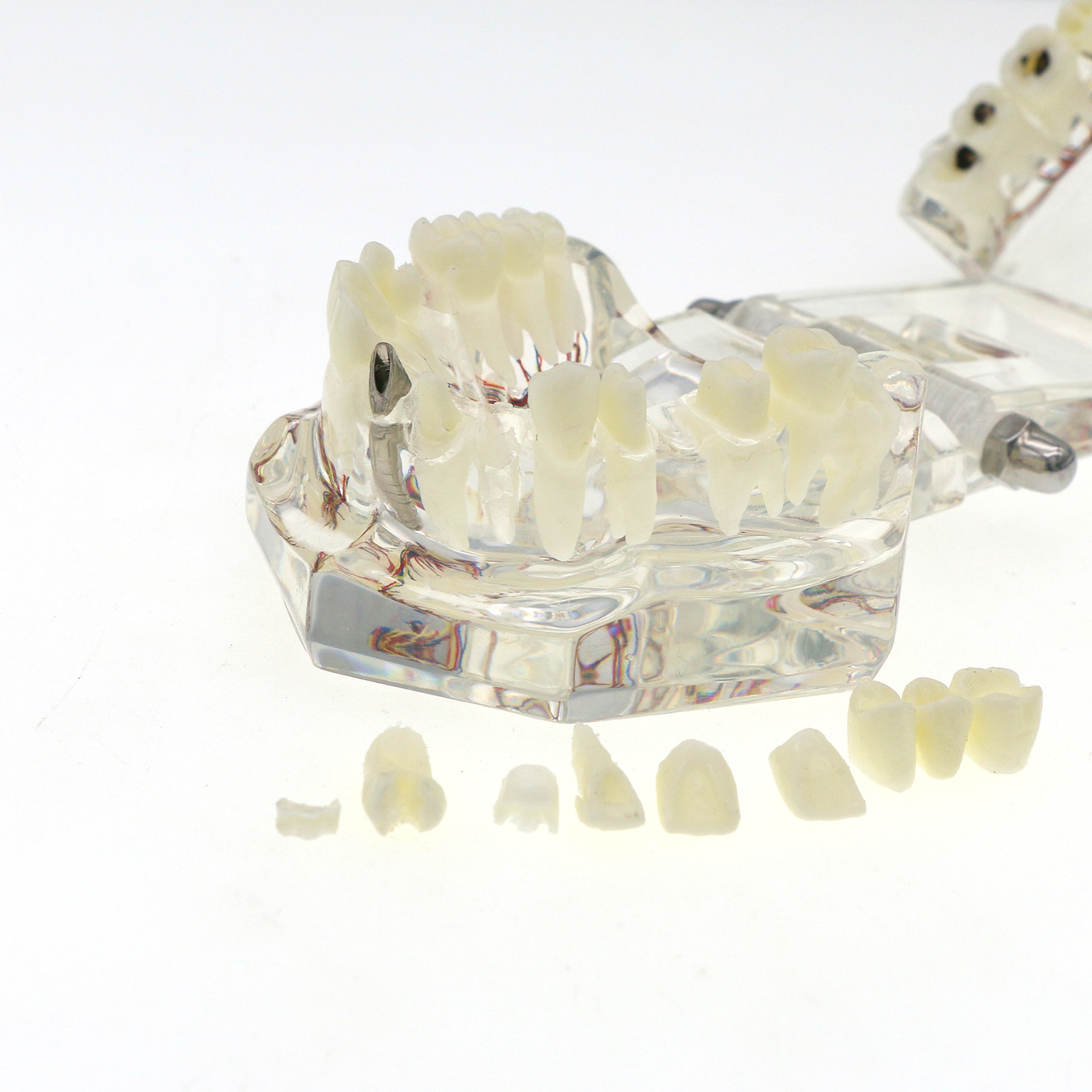 Dental Oral Typodont Model Implant Pathological Teaching Standard Size (Clear)