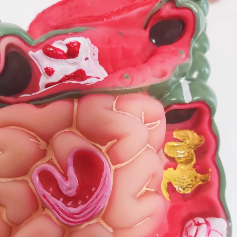 Removerable Human Stomach Anatomy Model Pathological Digestive System Model
