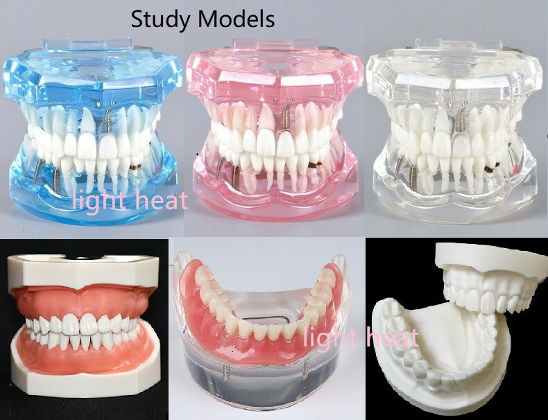 Dental Implant Teeth Model Disease Study Teaching Restoration Bridge Tooth Analy