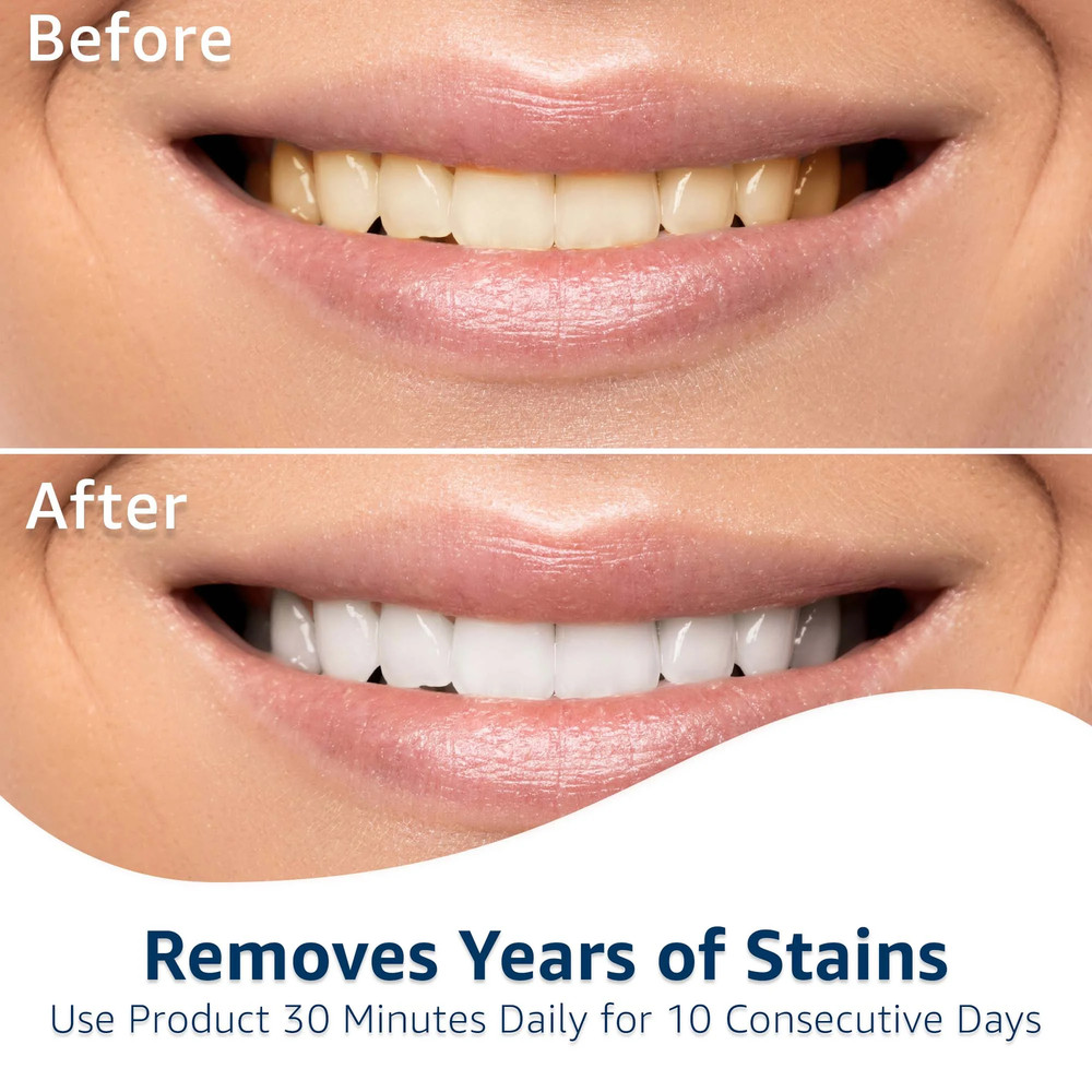 Equate 10 Day Timeless Whitening Strips, 20 Count