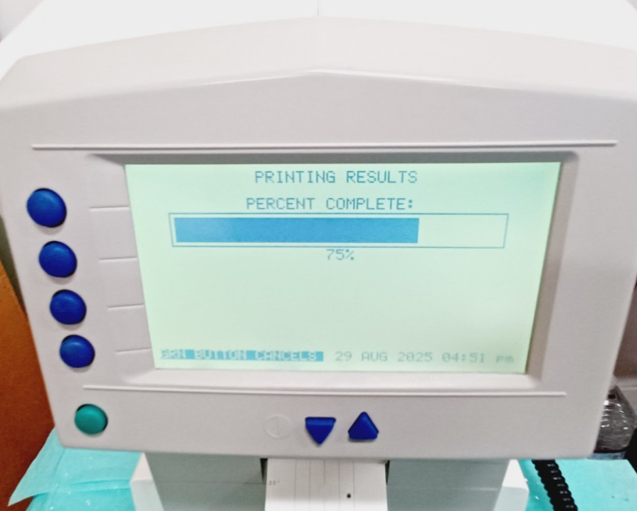 Carl Zeiss Humphrey FDT 710 Visual Field Analyzer! used Optometrist, Optometry