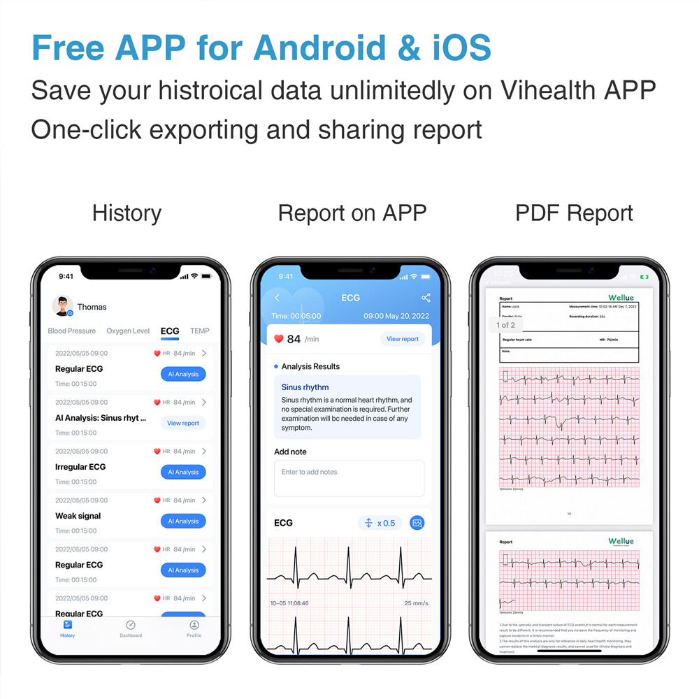 Touch Screen EKG Monitor Heart Monitor with ECG Cable AI-ECG Analysis via App
