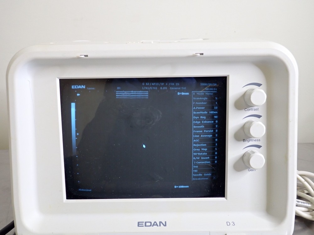 Edan D3 Digital Ultrasonic Diagnostic Imaging System w/ L741 Linear Array Probe