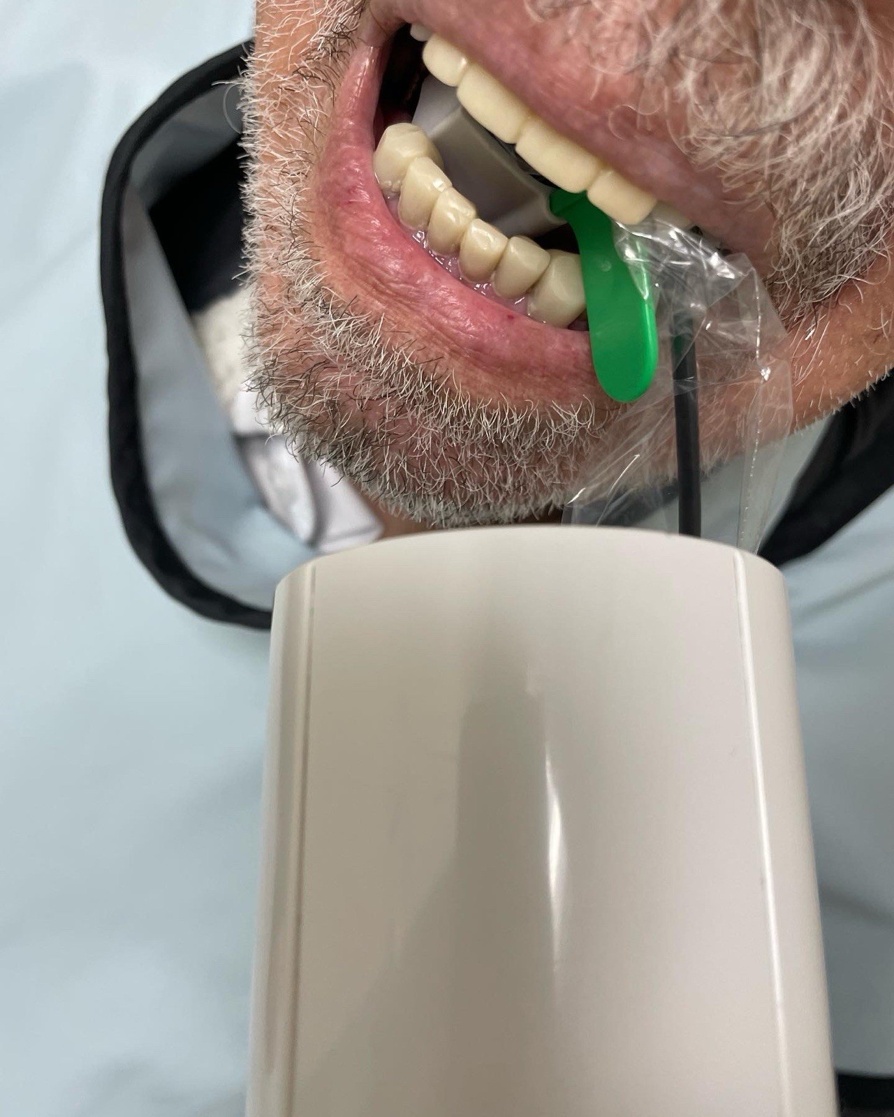 5 pcs Autoclavable - Apical/Bitewing Adult Digital Sensor Positioner-Holder