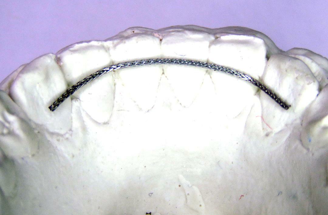 Dead Soft Flat Ortho Lingual Retainer Wire - 60" - Spool/ Roll/ Strips