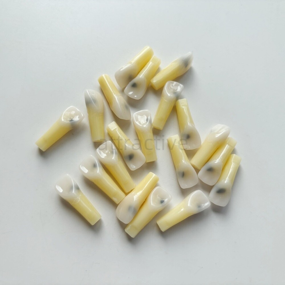 Dental Molar/Front Vitro Teeth Decay Caries Tooth Model Dentist Student Practise