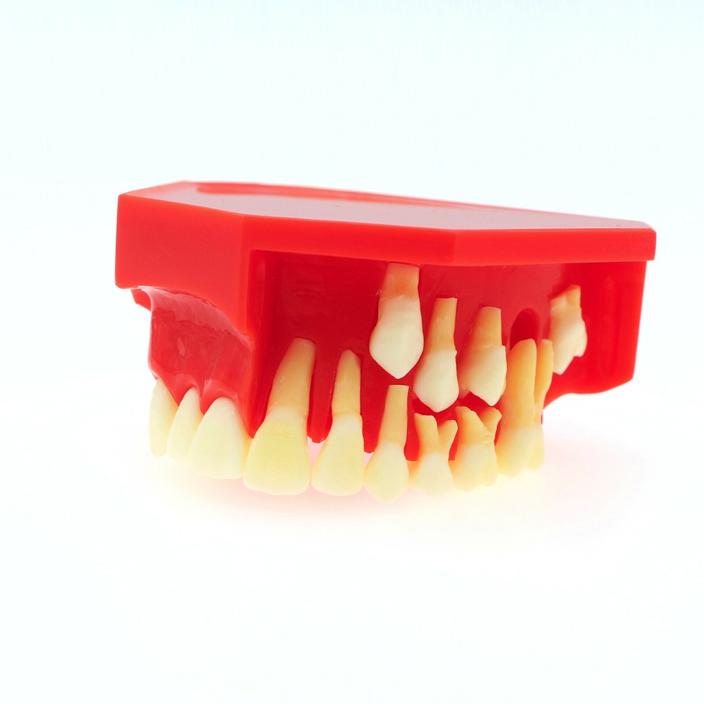 Dental Teeth Permanent Tooth Alternate Demonstration Study Teach Model M7013