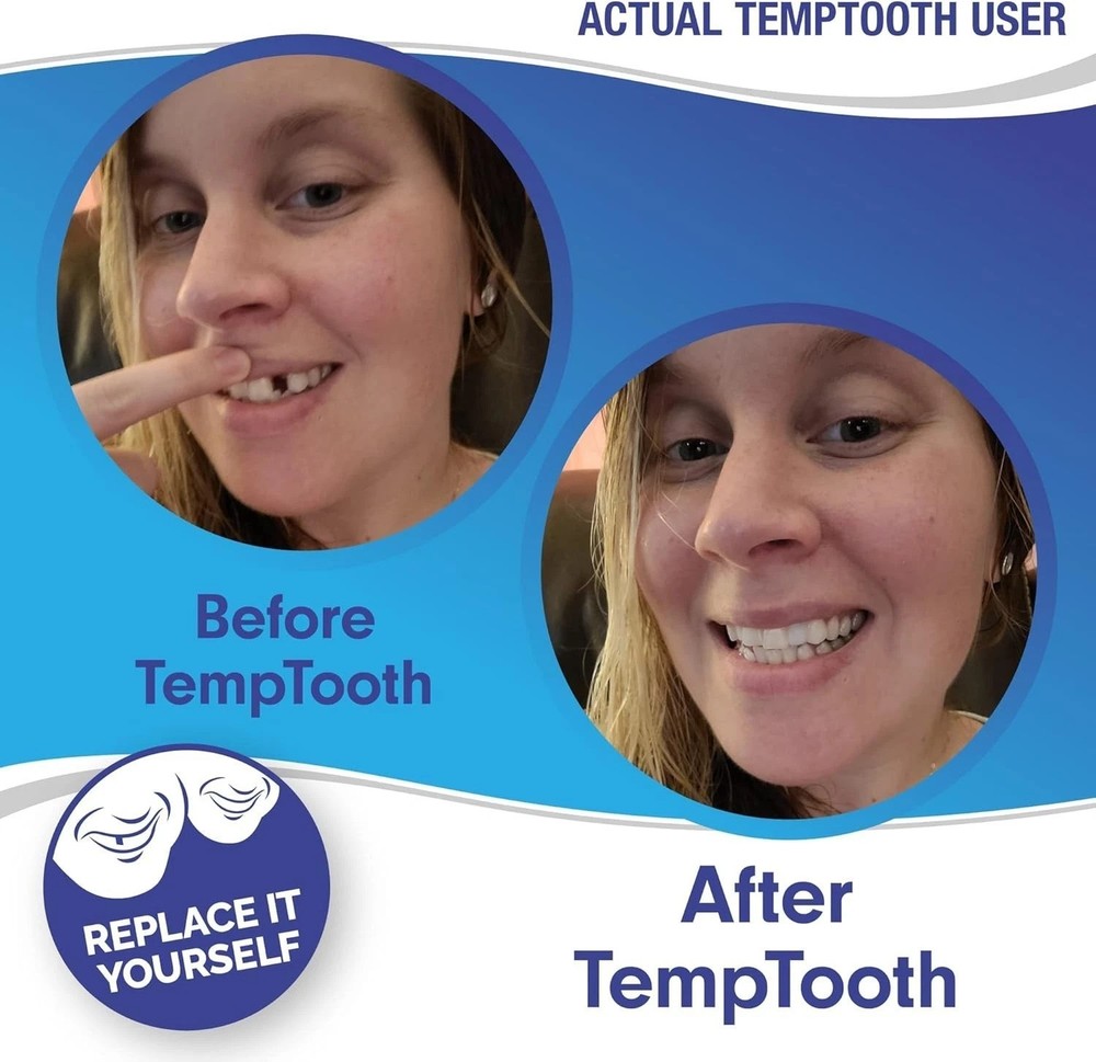 Complete DIY Temporary Tooth Replacement Kit - Create Up to 10 Realistic Teeth