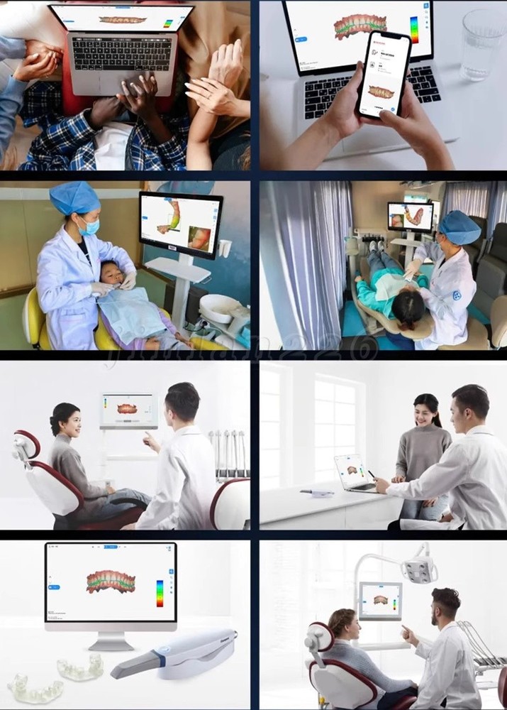 Intra-oral Scanner