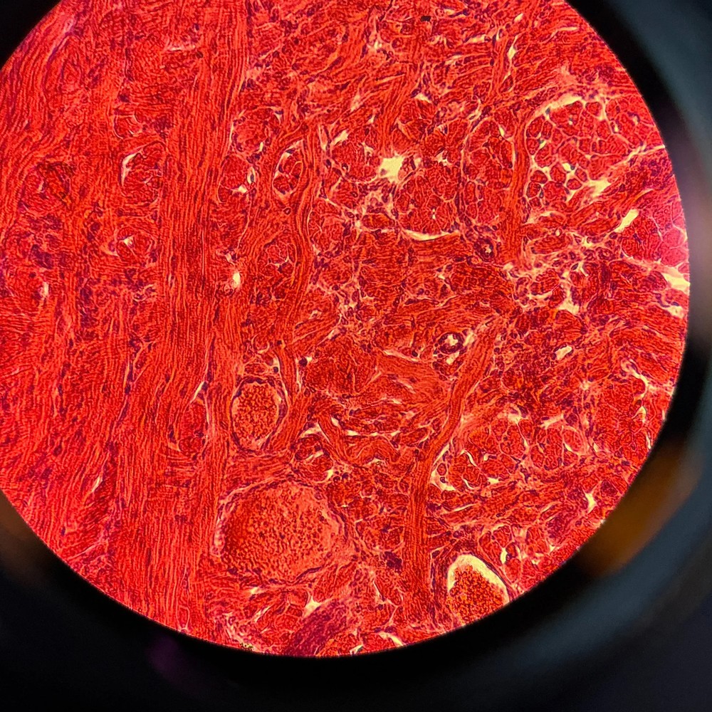 Nikon Eclipse TE200 Inverted Microscope Fluorescence Hoffman Constrast