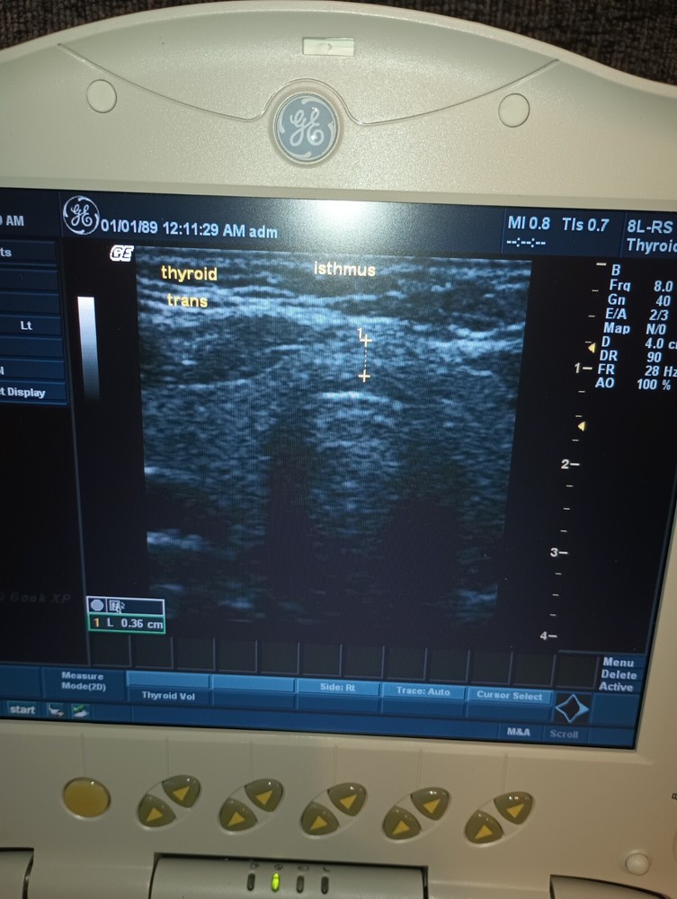 GE Logic Xp Ultrasound Machine