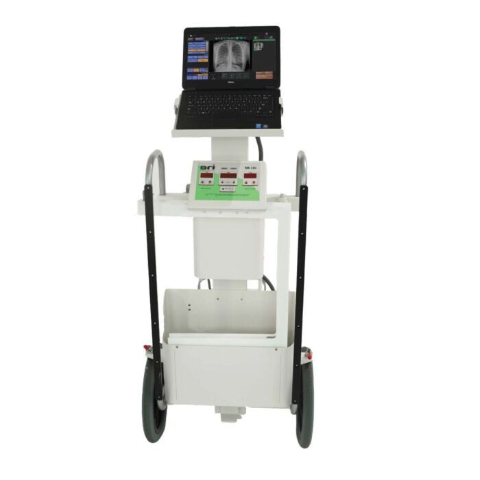 mobile digital ray machine minxray
