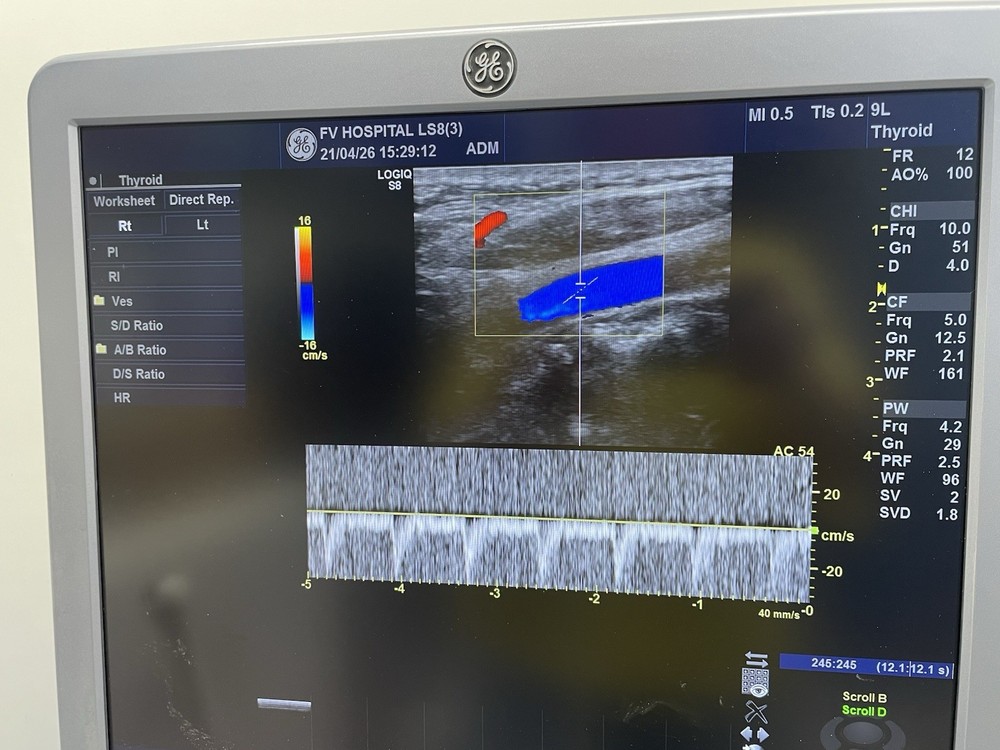 Ge ultrasound probe Linear 9L-D