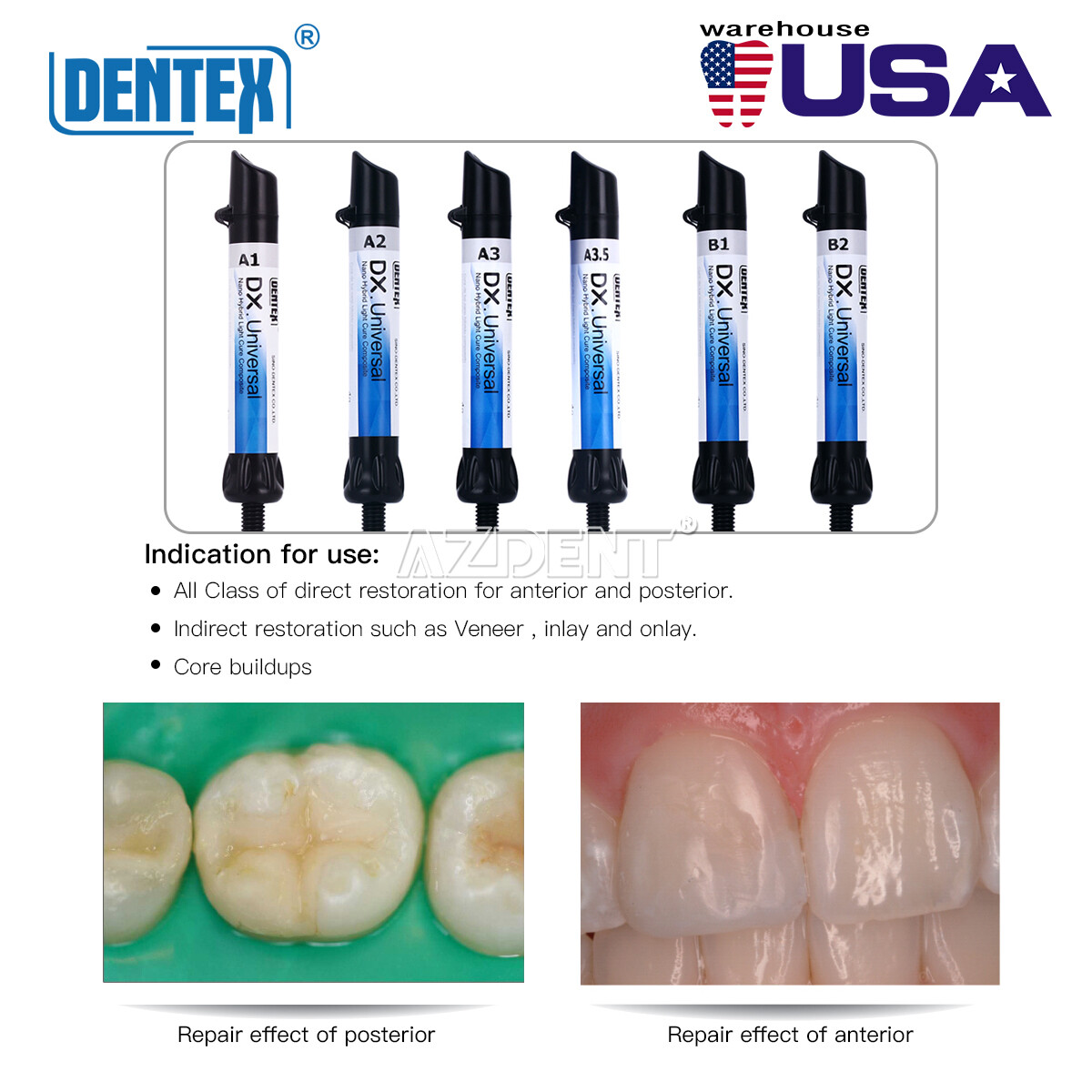 Dentex Dental Universal A1 A2 A3 A3.5 B1 B2 Recambio de Resina Compuesta de Foto