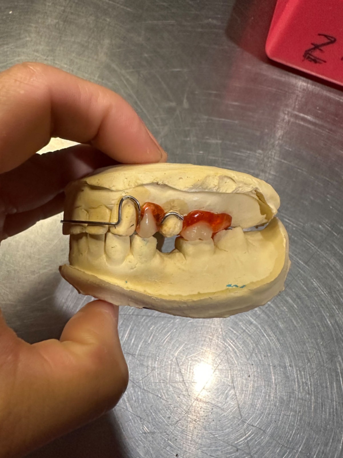 CUSTOM HAWLEY RETAINERS/Orthodontic Dental Braces ( FREE shipping & Imp Kit )