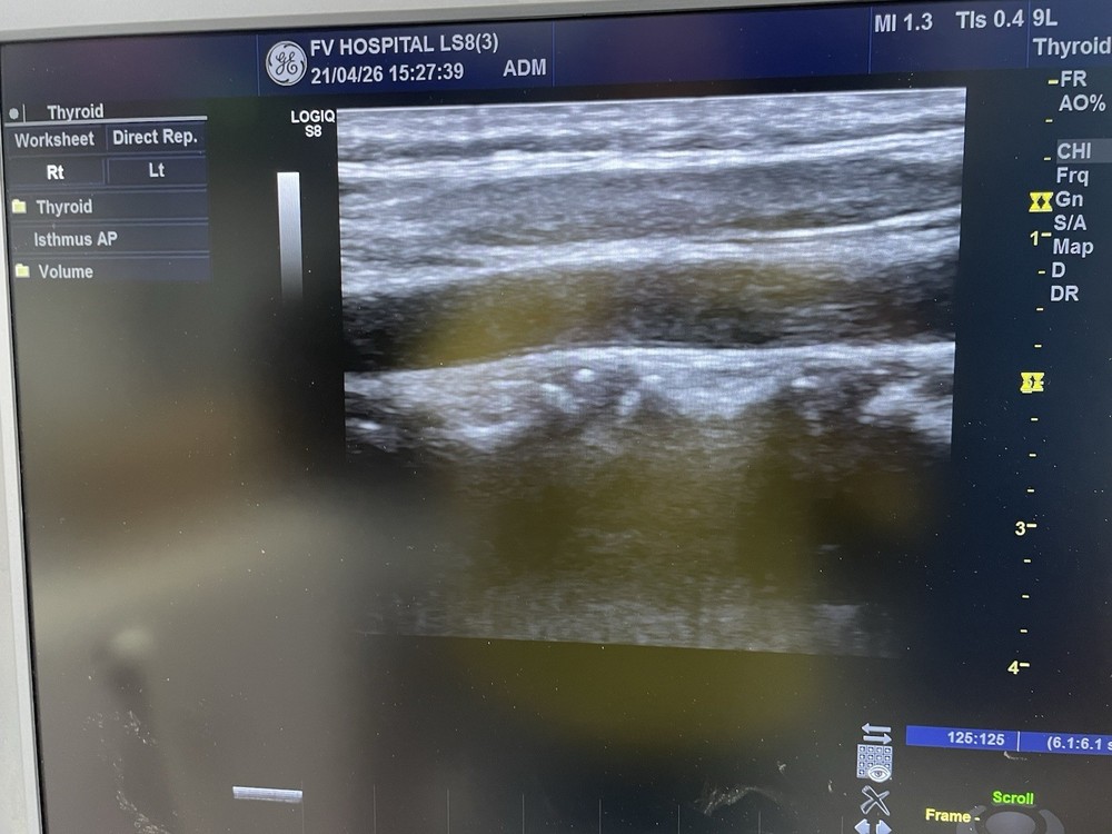 Ge ultrasound probe Linear 9L-D