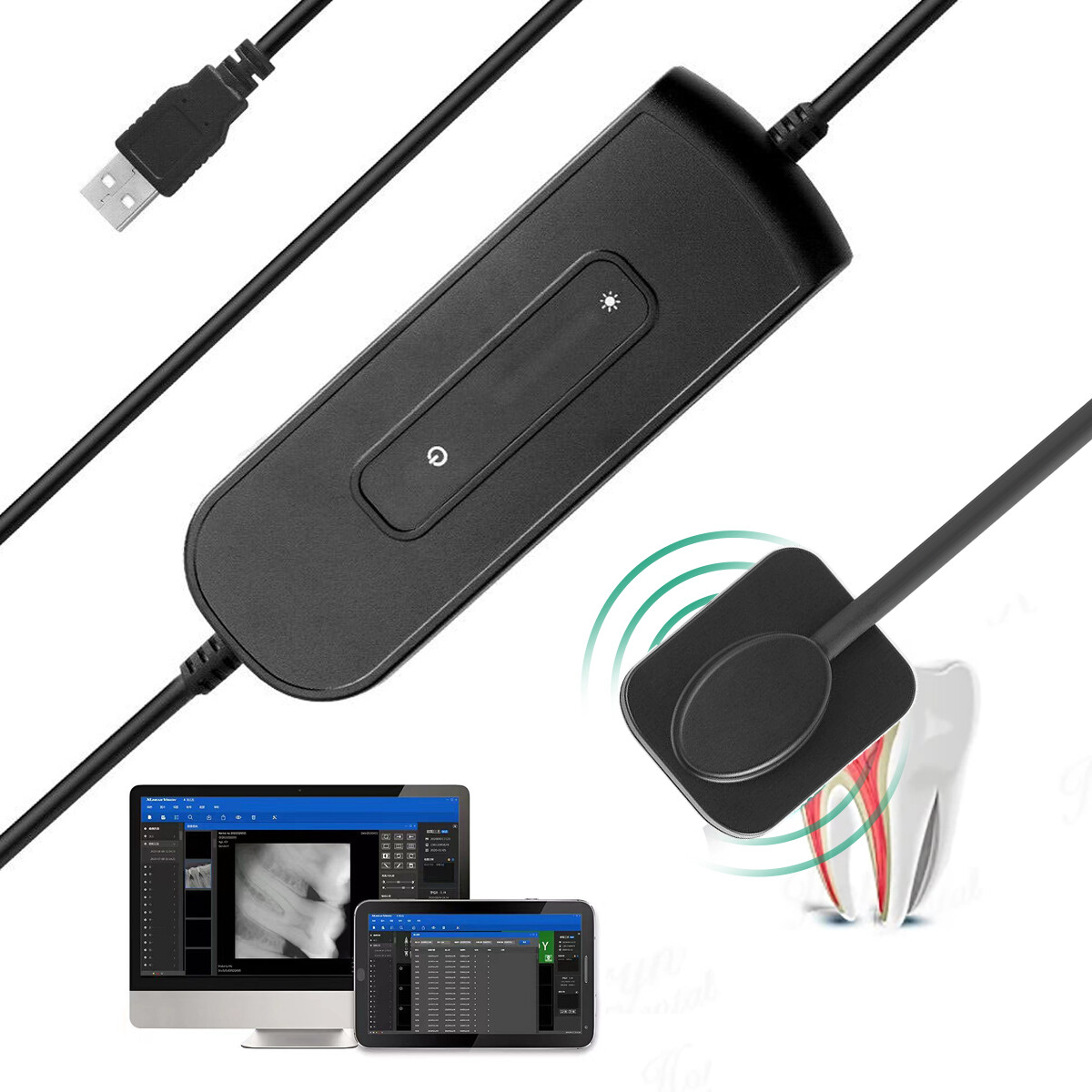 Rayos X Intra-oral ray 1.0 Sensor Digital Imaging System