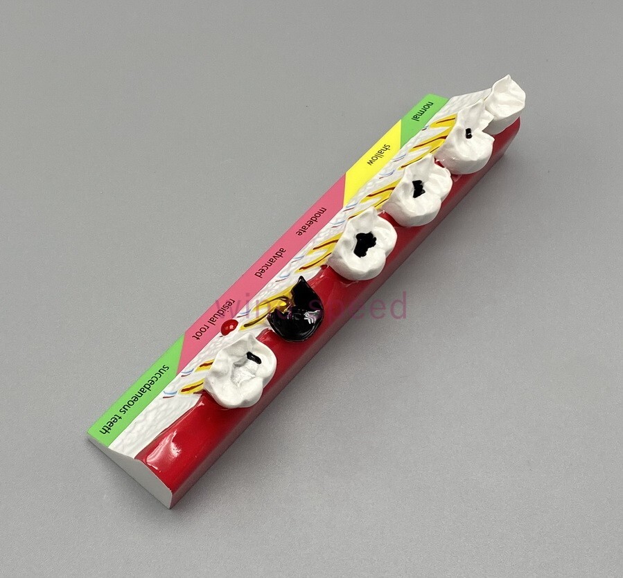New Dental Study Teaching Models Caries Disease Assort Teeth Dentoform Model