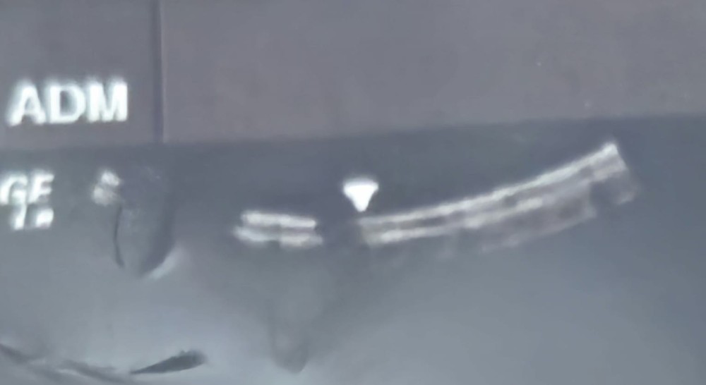 GE C1-5 RS Convex Probe