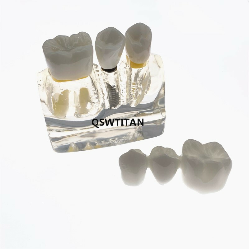 Dental Demonstration Study Teeth Model for Implant Analysis Crown Bridge Model