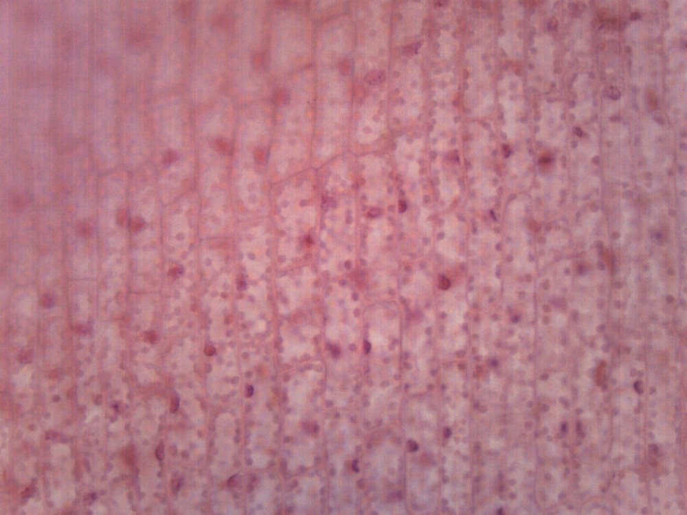 25PK Chloroplasts, Prepared Microscope Slides, 75x25mm - Eisco Labs