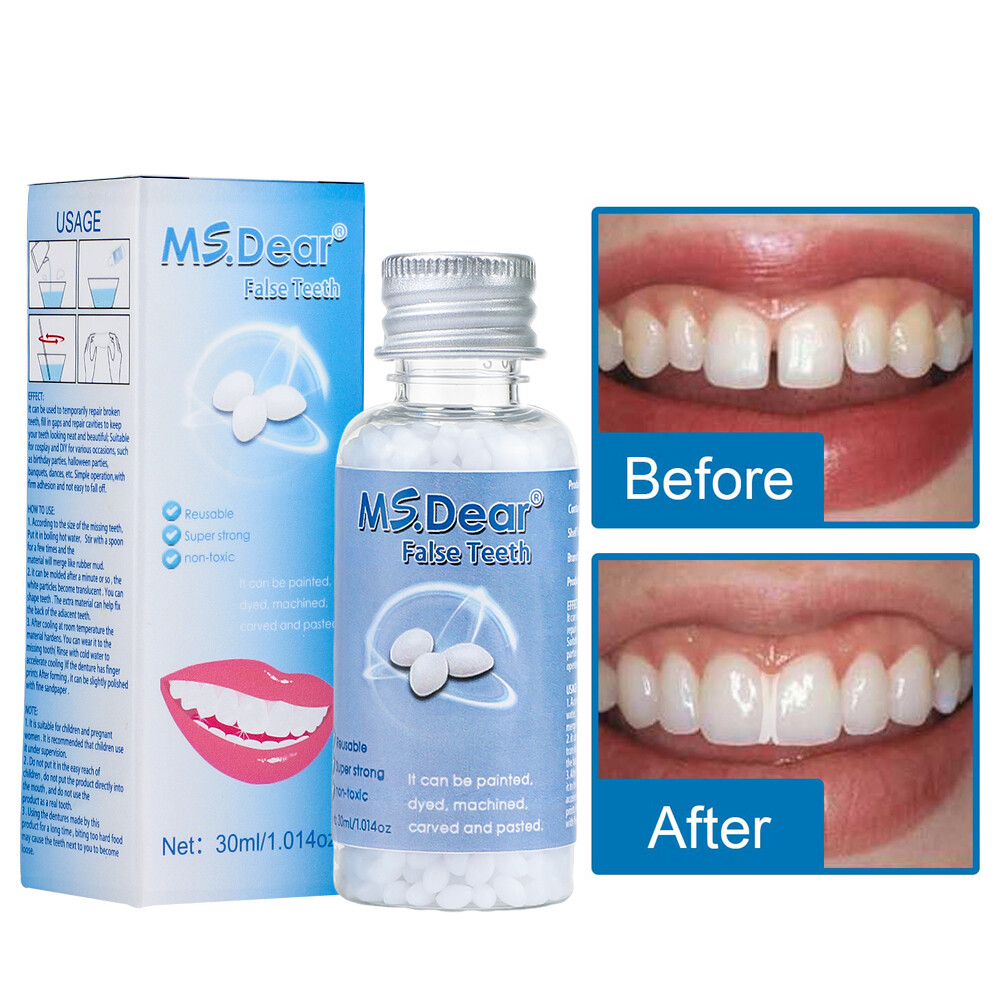5/3x Tooth Repair Granules Temporary Fitting Beads Reusable Moldable False Teeth