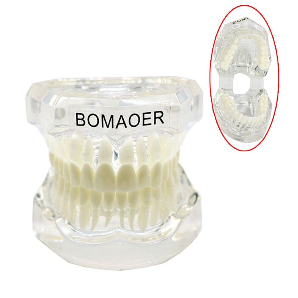 1×Yellow Transparent Plastic Study Teeth Model Demonstrate Comprehensive Repair
