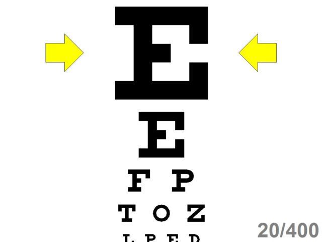 Ophthalmic Optometric Computerized Visual Acuity Software - Excellent Value