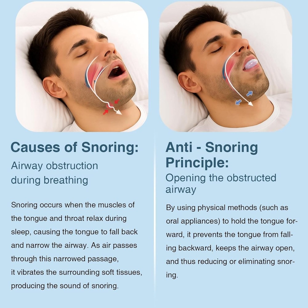 2Pcs Anti Snoring Device Sleep Snoring Solution Reusable Snore Solution Stopper