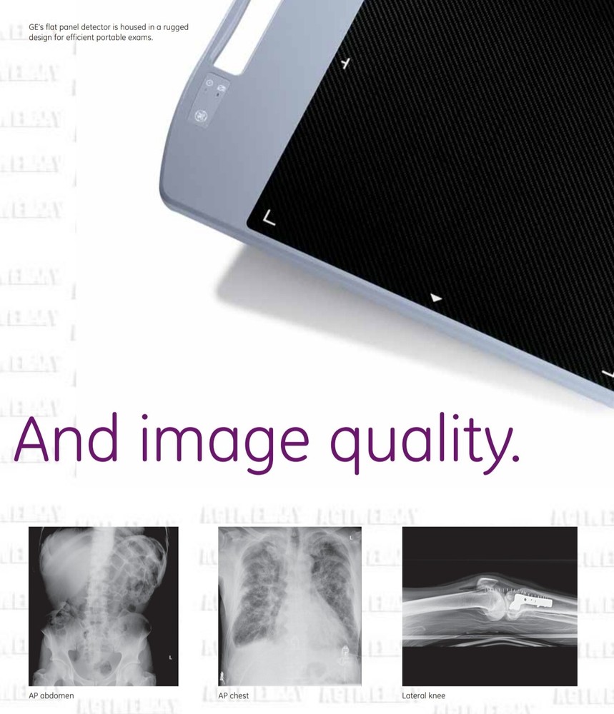 GE AMX 700 mobile imaging