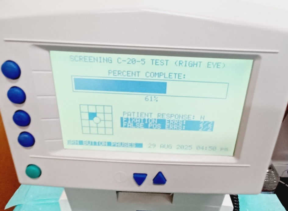 Carl Zeiss Humphrey FDT 710 Visual Field Analyzer! used Optometrist, Optometry