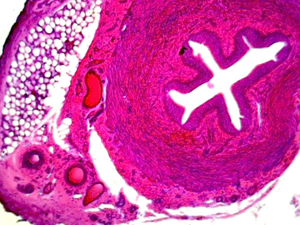 Ureter, Human; Showing Tissue Layers; Cross Section
