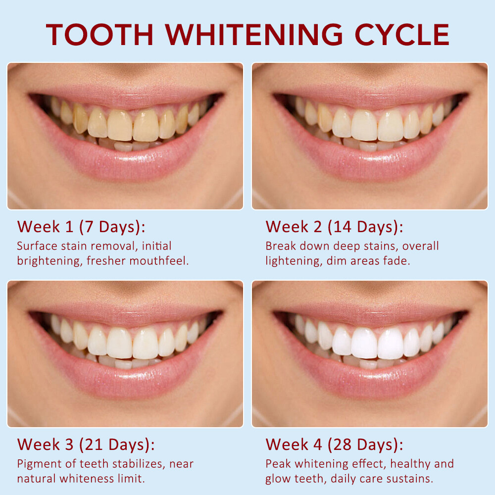 2PC Sp-6 Probiotics Whitening Toothpaste Brightening Breath Removing Toothpaste