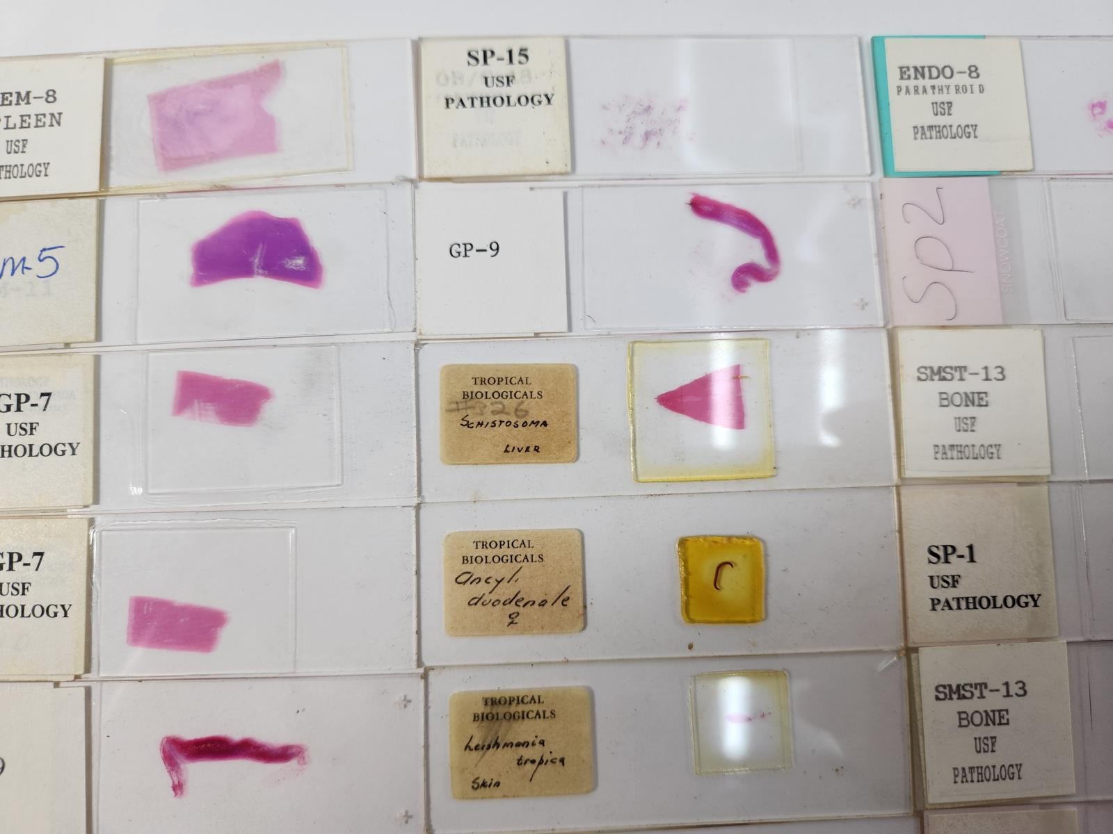 Lot Of 50 Vintage University Prepared Pathology Microscope Slides - Slides Only