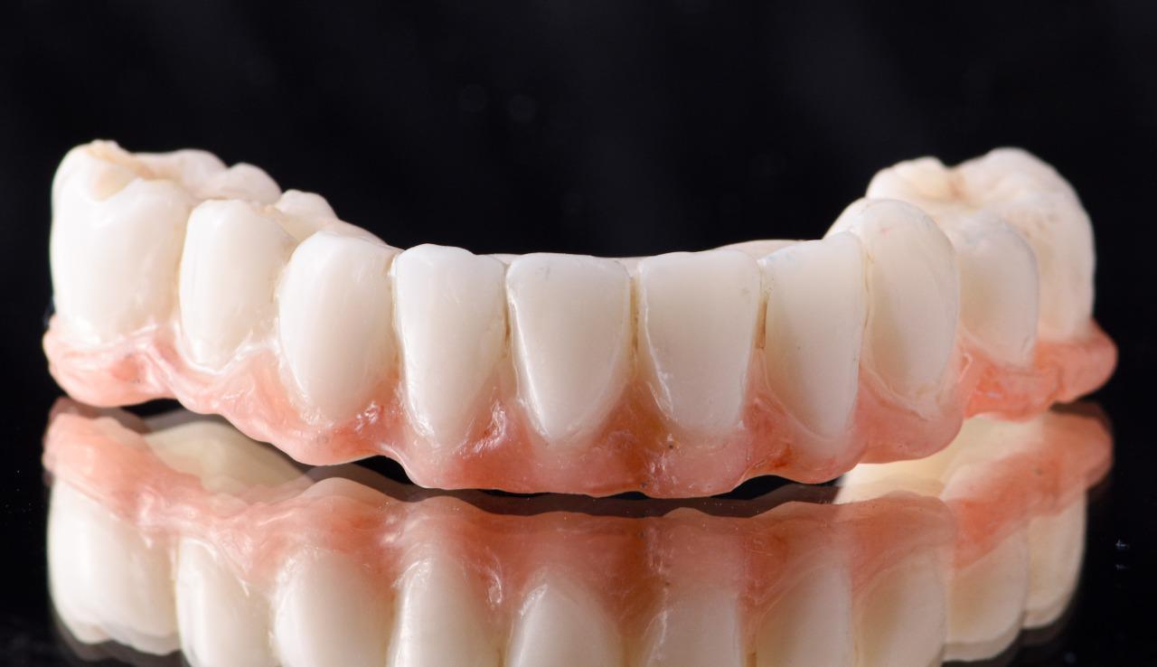 DLP SLA LCD 3d printer ALL ON X resin - for all on x cases, bridges,arcs, hybrid