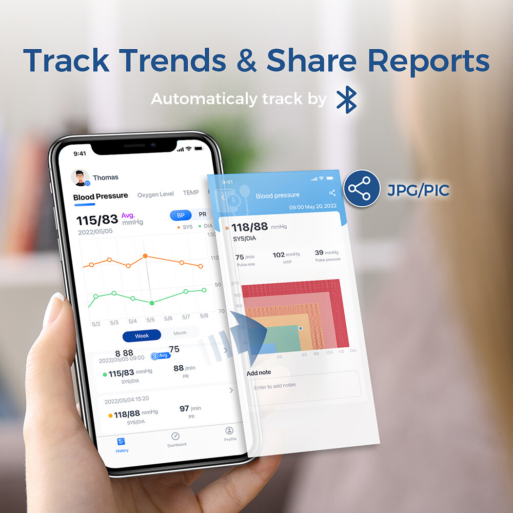 Wellue BP2 Blood Pressure Monitor with EKG Monitor AI-ECG Analysis, Refurbished