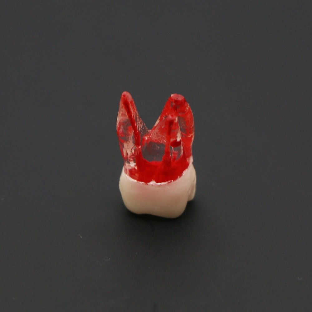 Dental Typodont Endodontic Practice Pulp-Opened RCT Root Canal Teeth Model M8008