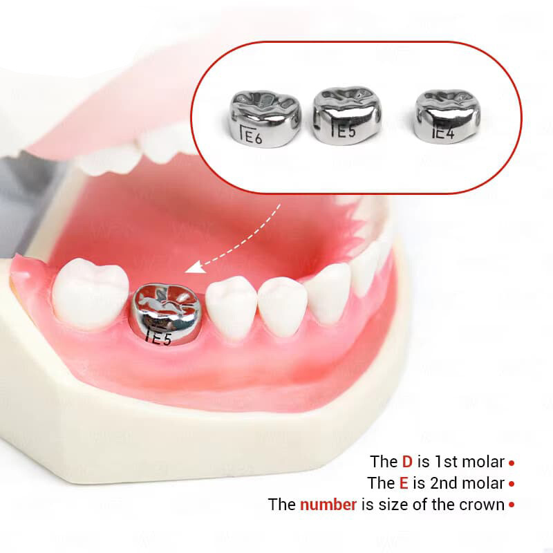 48 ASSORTED PRIMARY MOLAR STAINLESS STEEL CROWNS - COMPLETE KIT