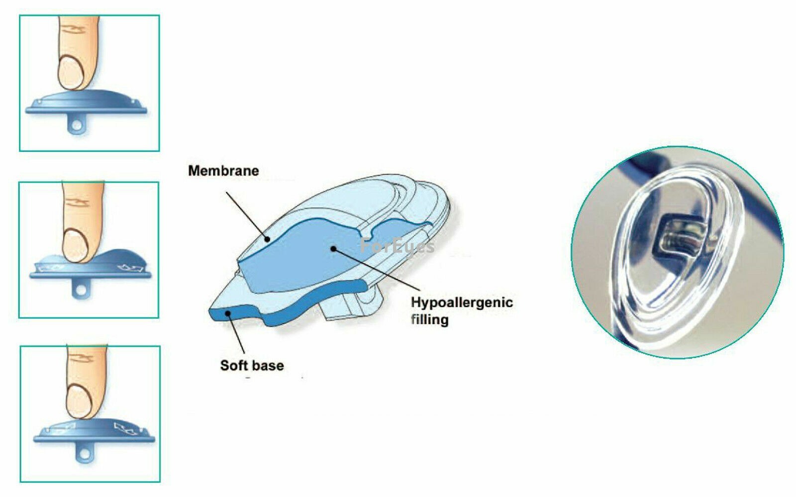 Biofeel Style ComfyGEL® Gel Filled Nose Pads 14mm. PUSH & SCREW TYPE Available