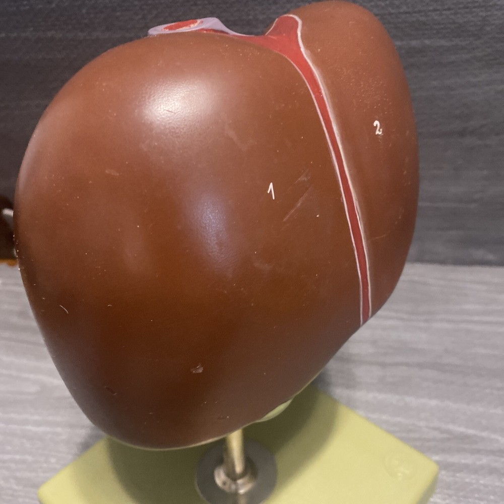 Somso Liver On Adjustable Stand Model - Numbered - Damaged