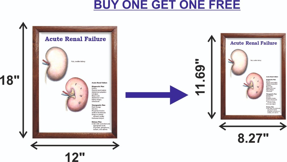 Acute Renal Failure Chart 12x18 inches